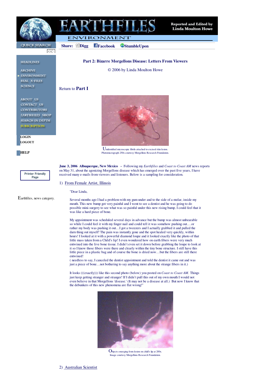 06 03 2006 Part 2 Bizarre Morgellons Disease Letters From Viewers cover