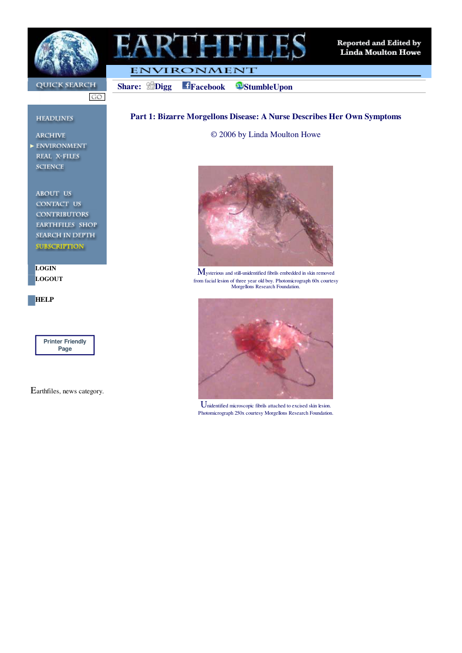 06 01 2006 Part 1 Bizarre Morgellons Disease A Nurse Describes Her Own Symptoms cover