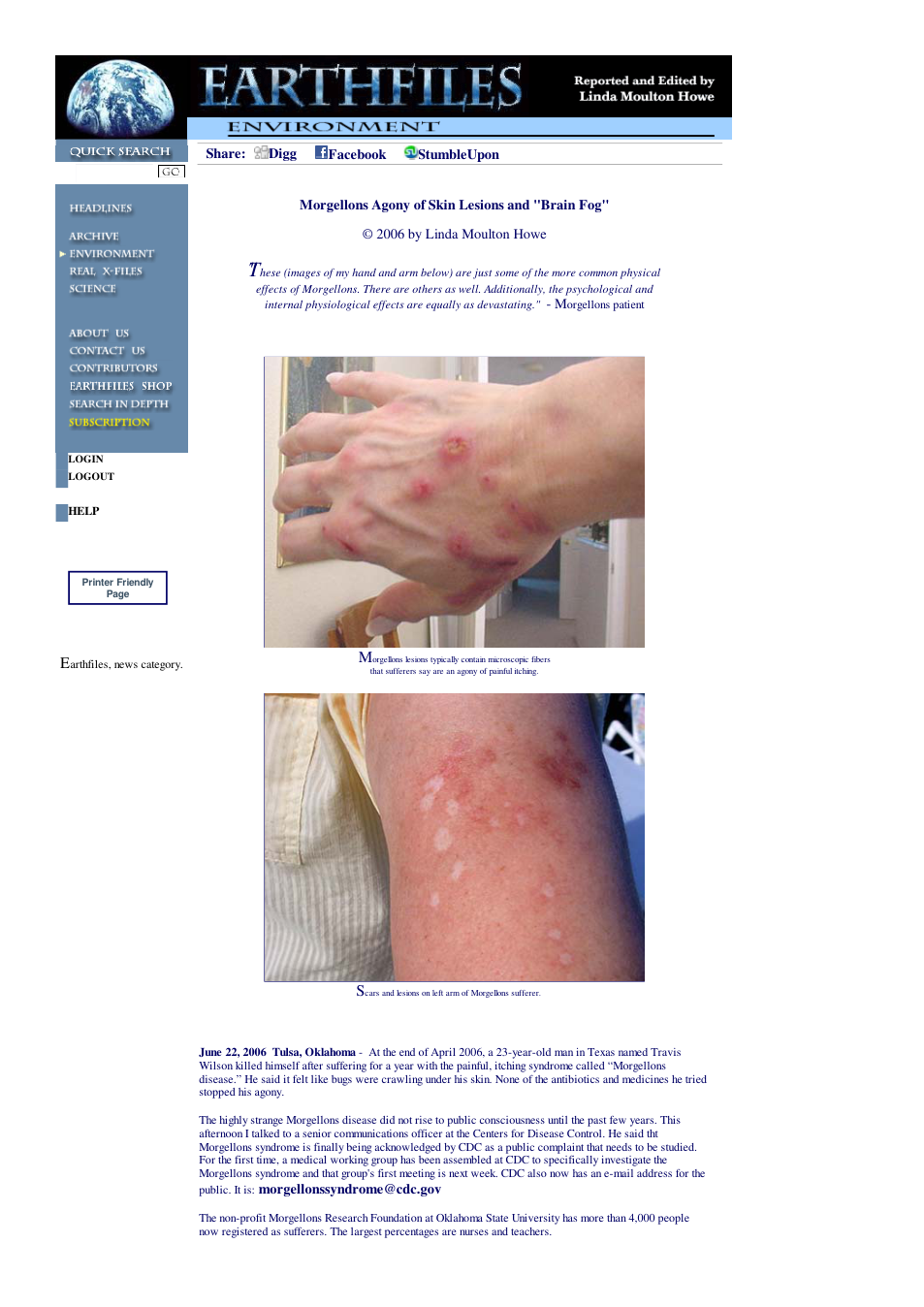 06 23 2006 Morgellons Agony of Skin Lesions and Brain Fog cover