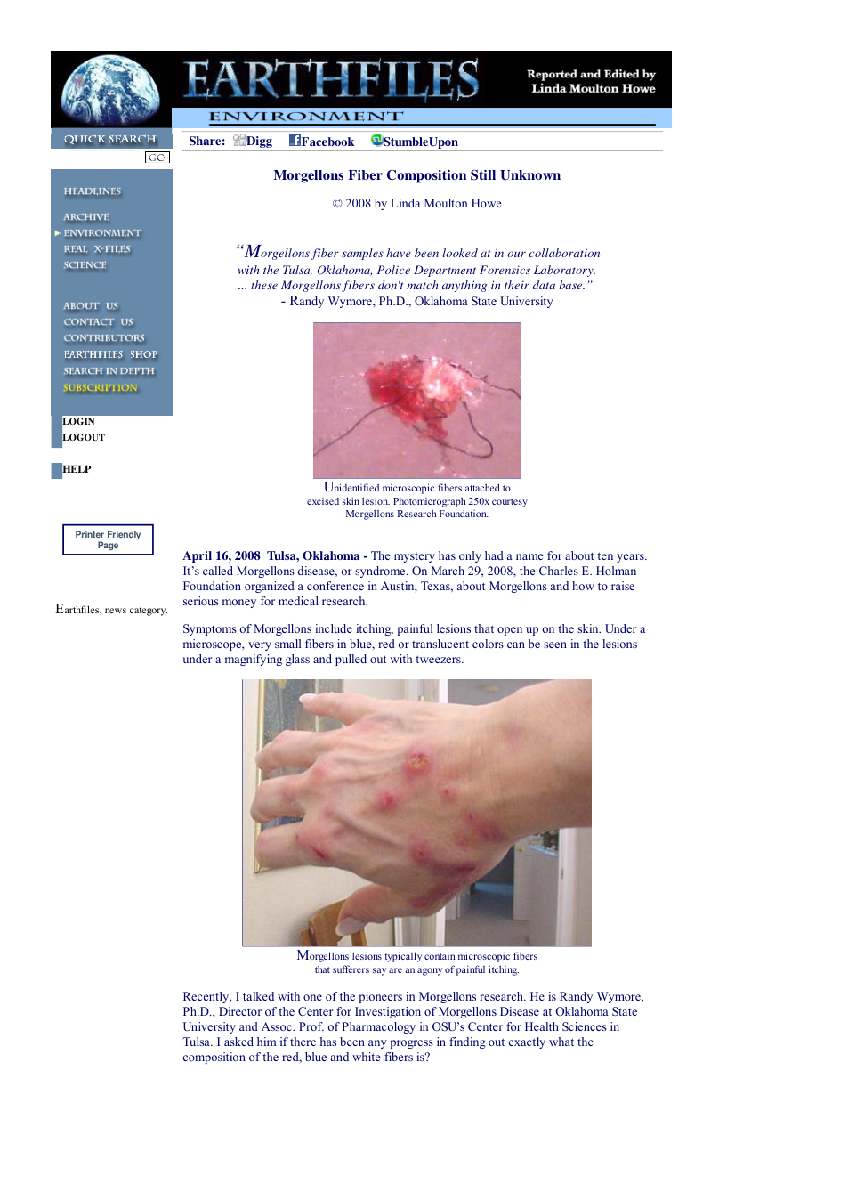 04 16 2008 Morgellons Fiber Composition Still Unknown cover